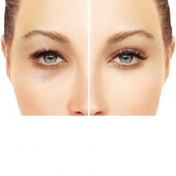 Лентички за повдигане на клепачите 120 бр -foto3